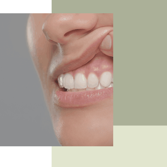 leczenie periodontologiczne Katowice