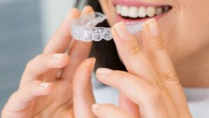 Invisalign czy zwykły aparat ortodontyczny