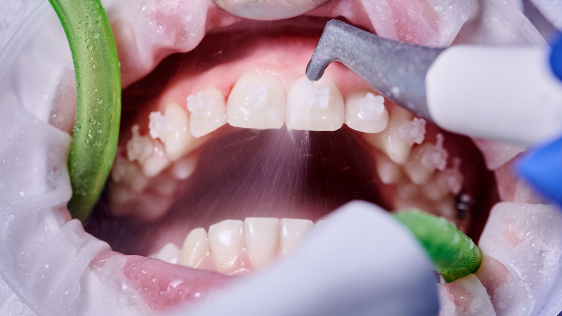 Periodontolog katowice